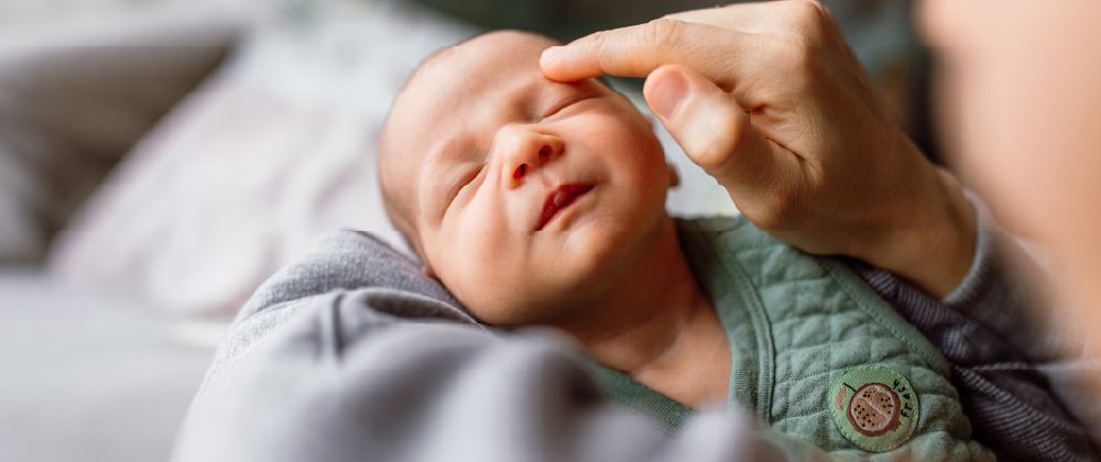 Infantile hemangiomas: a guide for parents