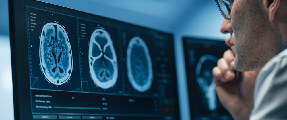 Stroke: Through the Eyes of the Interventional Neuroradiologist