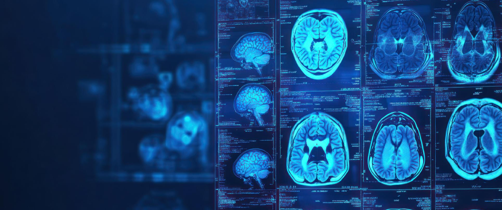 Neuroradiology: the Minimally Invasive Therapy LiTT